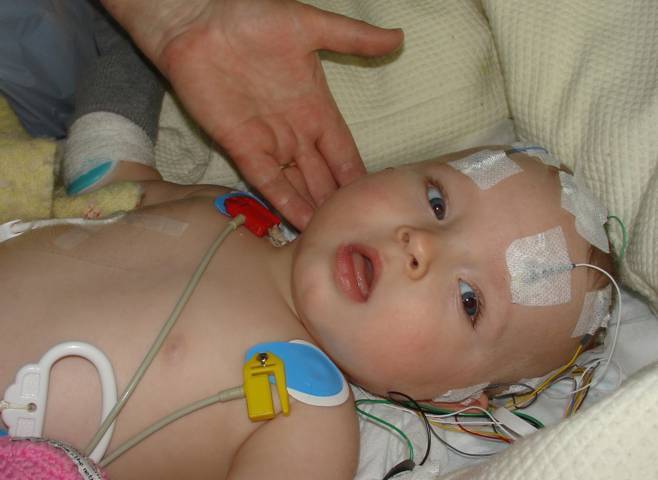 Biến chứng nguy hiểm của bệnh